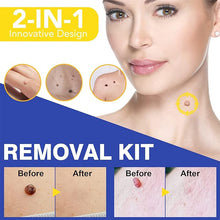 Load image into Gallery viewer, Remover, 2 in 1 Head Tools Kit Comprehensive Accessory, Suit for Multi Size (2in1 Easy Tool)