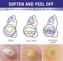 Load image into Gallery viewer, Dr. Luke Liquid Wart &amp; Corn Gel Maximum Strength Exclusive Formula Common and Flat Wart Liquid, Fast-Acting Corn Removal Mask for Plantar
