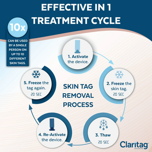 Claritag Advanced Skin Tag Removal Kit Cryogenic Freeze Off Skin Tags Remover