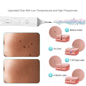 Age Spot Mole Wart Freckle Tattoo Removal Machine Laser Pen Skin Tag Remover Pen