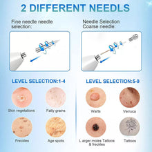 Load image into Gallery viewer, Age Spot Mole Wart Freckle Tattoo Removal Machine Laser Pen Skin Tag Remover Pen

